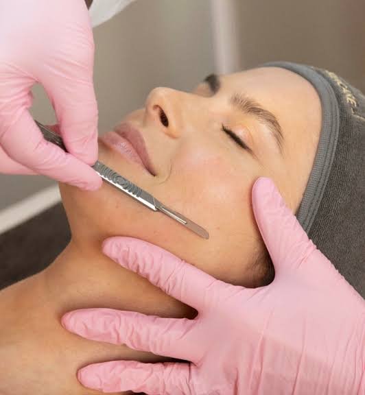 Dermaplaning at Skin Forma, Luton